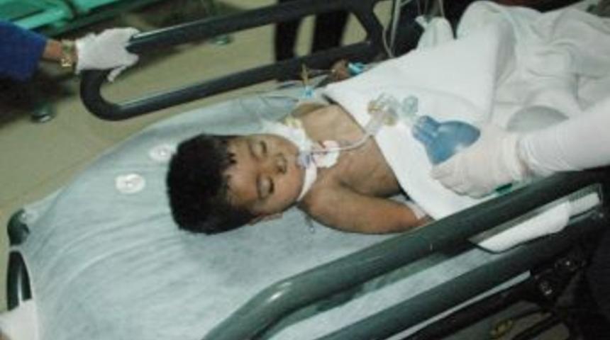 Yangında Ağır Yaralanan &Ccedil;ocuk Hayatını Kaybetti