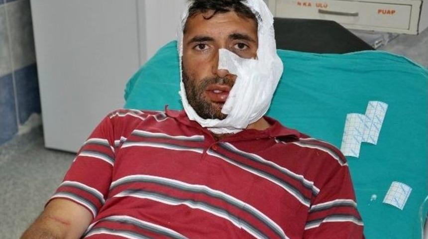 Sivas&rsquo;ta Kurt Saldırısı 6 Kişiyi Hastanelik Etti