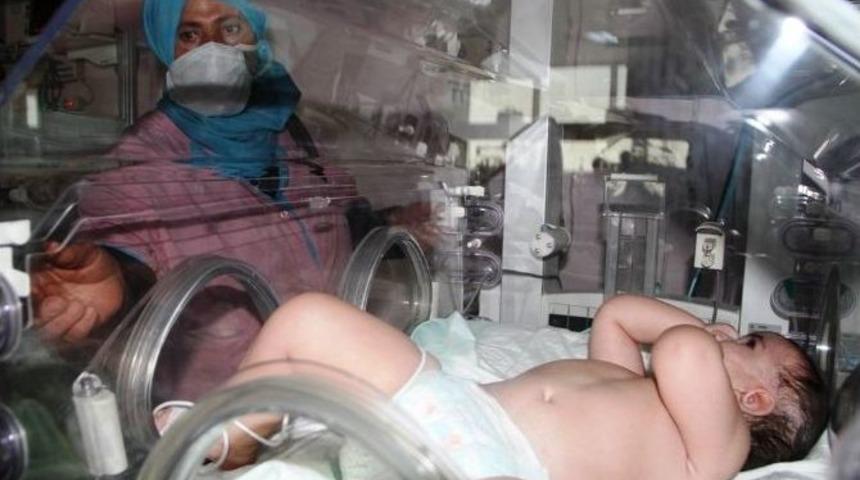 (özel Haber) "yaşamaz" Denilen Gülnur Bebek Ameliyatla Hayata Tutundu