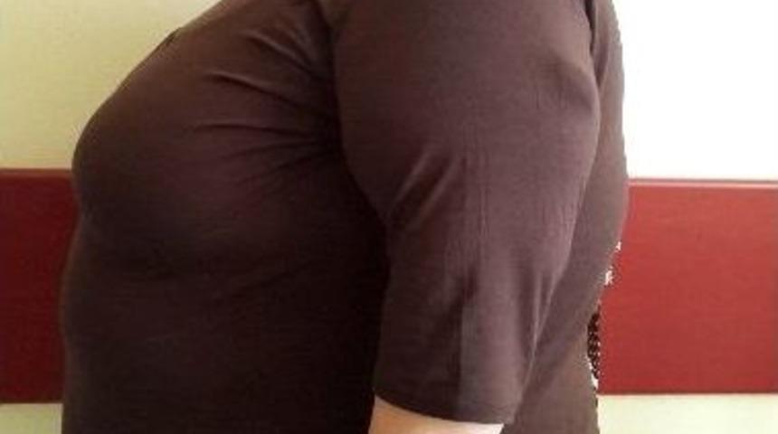 Gazi Yaşargil Hastanesi Obezitede Umut Kapısı Oldu