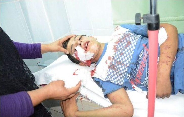 Nusaybin’de Olaylarda Bir Çocuk Yaralandı
