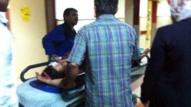 Etek Kazaya Neden Oldu: 2 Yaralı