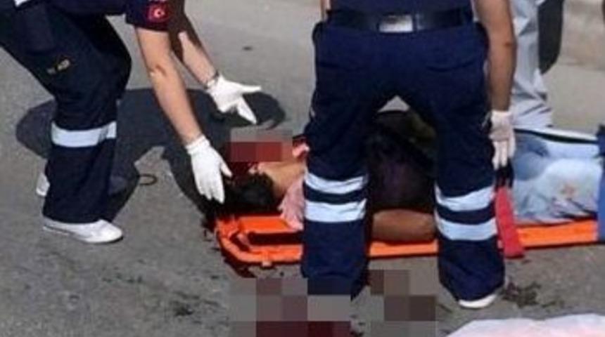 Yaralı S&uuml;r&uuml;c&uuml;n&uuml;n Yardımına İlk Koşan Kişi, Otomobiline &Ccedil;arptığı Doktor Oldu