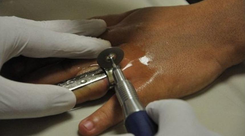 Hamile Kadına Y&uuml;z&uuml;k Operasyonu