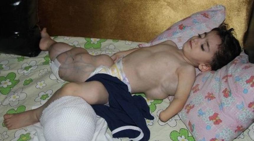 (&ouml;zel Haber) V&uuml;cudu Şişen &Ccedil;ocuğun Hastalığına Teşhis Konulamadı