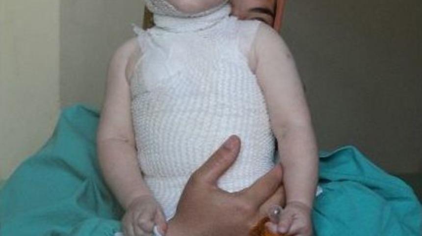 &Uuml;zerine Sıcak Su D&ouml;k&uuml;len &Ccedil;ocuk Yandı