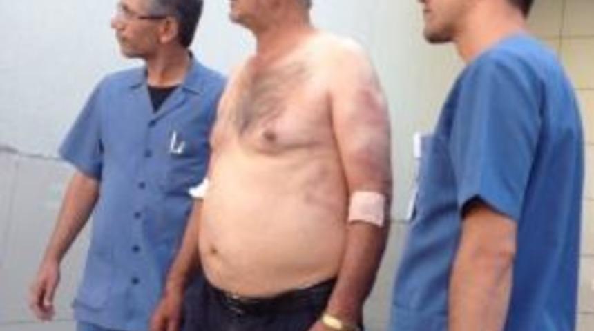 Babalarını Sopalarla D&ouml;verek Hastanelik Ettiler