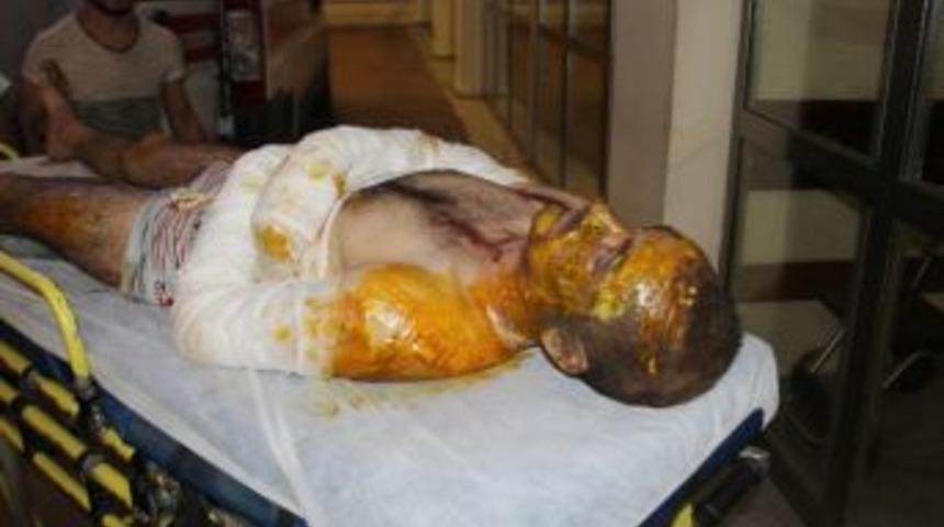 Şanlıurfa’ya Getirilen Suriyeli Hayatını Kaybetti