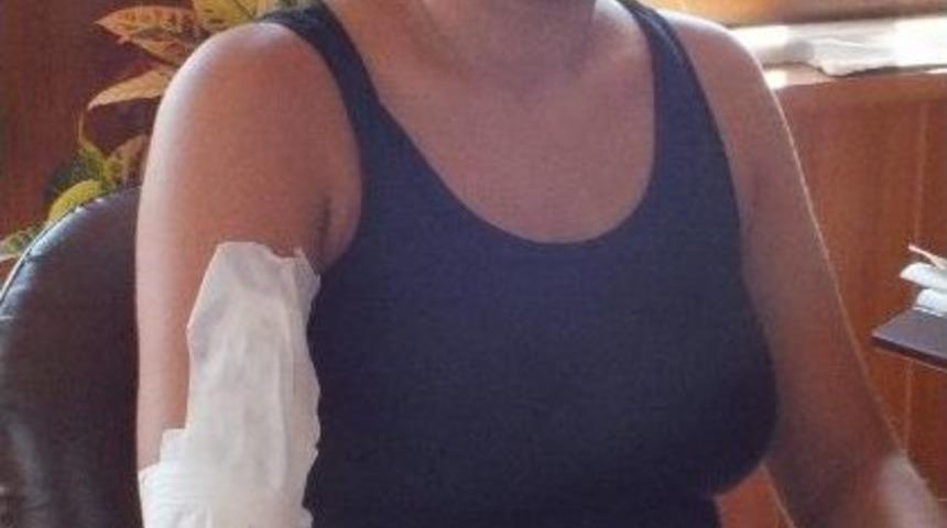 Yolda Y&uuml;r&uuml;yen Kadının Başına Beton Par&ccedil;ası D&uuml;şt&uuml;