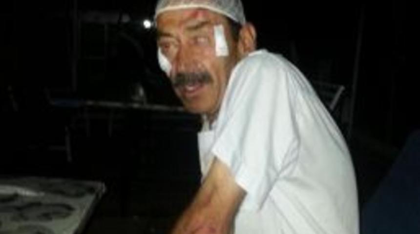 Yaralı S&uuml;r&uuml;c&uuml; Karakolda Yaptığı Kazayı Hatırlamadı