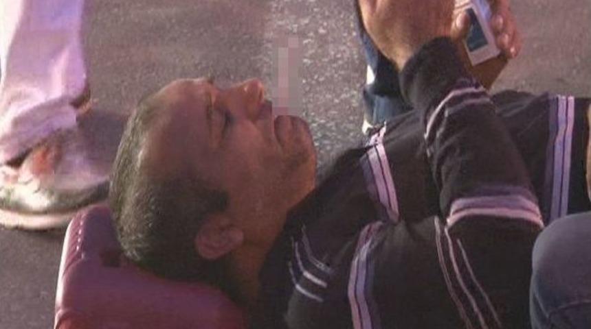 Kazada Yaralandı, Sigaraya Sarıldı