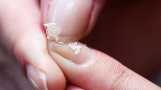 Tırnağınız hemen kırılıyorsa dikkat! 