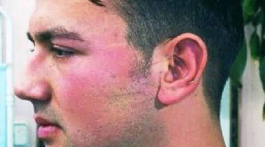 Maraş Akupunktur Merkezi Hastalara Umut Oldu