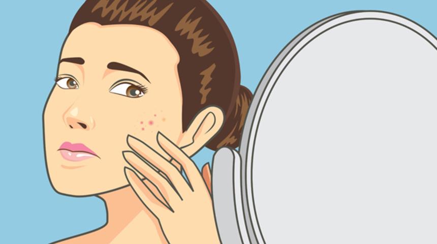 Sivilce izlerine veda edin 