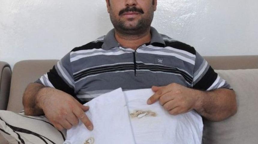 V&uuml;cudunun Aniden Yandığını İddia Ediyor