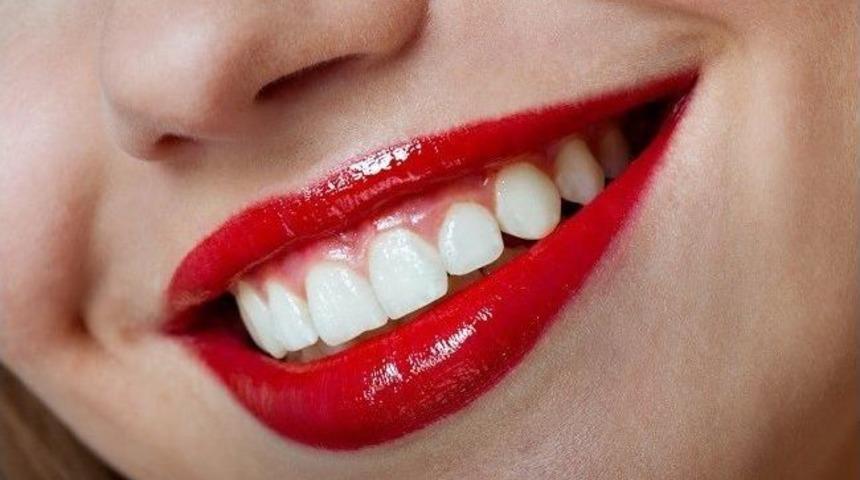 Muhteşem Bir G&uuml;l&uuml;msemenin Keyfini &Ccedil;ıkarın