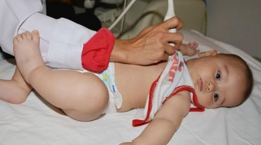 Beş Aylık Bebeğe Anjiyo Yapıldı