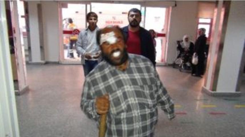 Engelli Vatandaşı Darp Ettiler