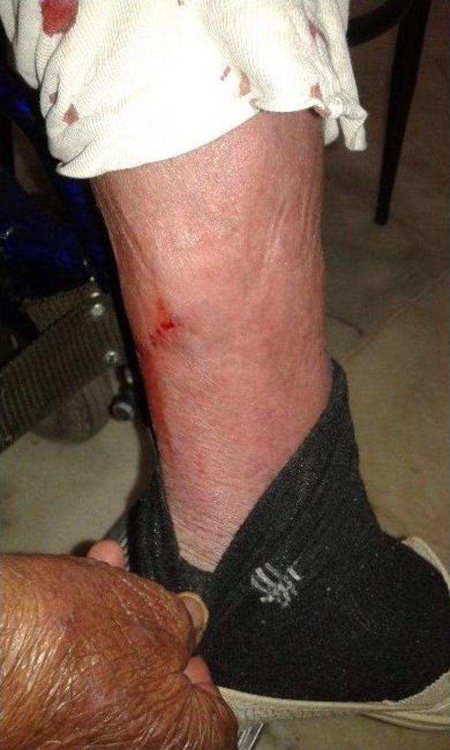 Hastalığı Değil Bindiği Otob&uuml;s Canından Ediyordu 1