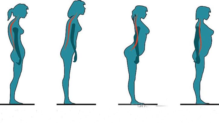 Duruşunuzu nasıl d&uuml;zeltirsiniz?