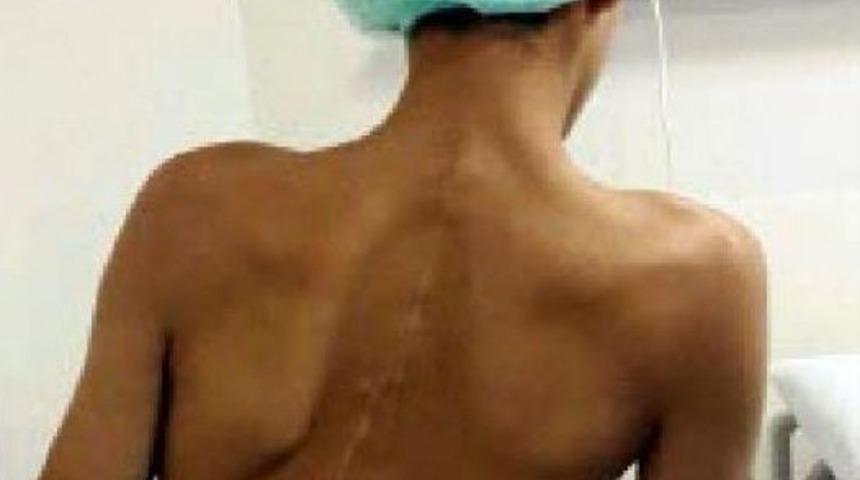 10 yıllık kabus, 7 saatlik ameliyatla sona erdi