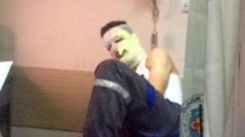 Fabrikada makine alev aldı, 2 iş&ccedil;i yaralandı