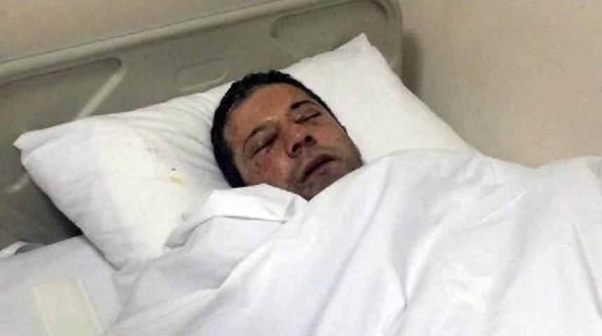 Okuldaki Deneyde Yaralanan Mert'in Umudu Yarın Olacağı Ameliyatta