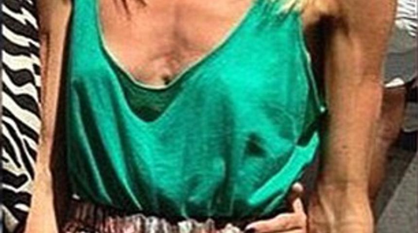 &Ouml;l&uuml;m&uuml;n eşiğinden d&ouml;nd&uuml;, bikini yarışmasına katıldı 