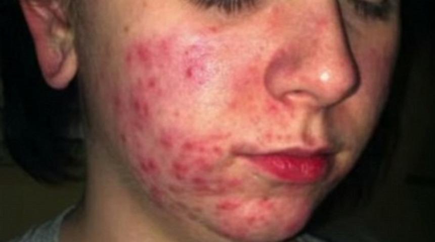 Spiral onu bu hale getirdi