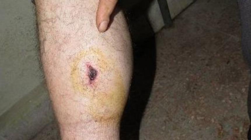 Kendisine Saldıran Domuzu Silahla Vurdu