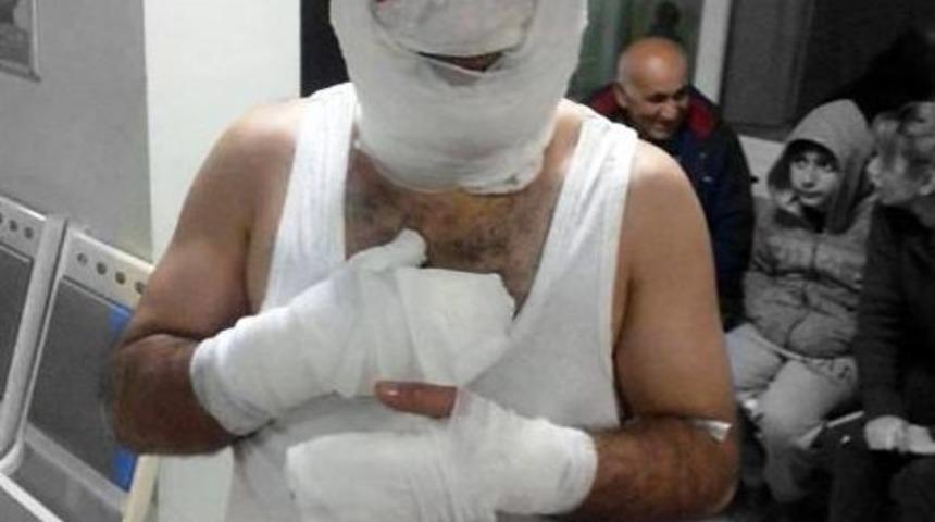 Patlayan Oda Parf&uuml;m&uuml; Karı Kocayı Yaktı