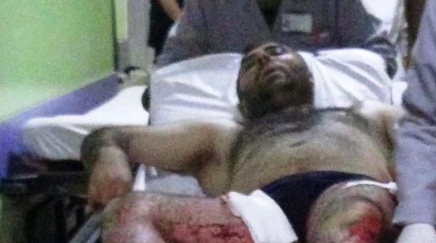 &Ccedil;ay İ&ccedil;me Kavgasında 4 İş&ccedil;i Bı&ccedil;akla Yaralandı