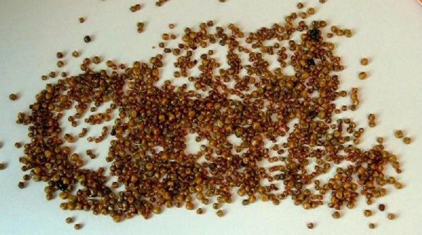 Safra Kesesinden 1200 Taş &Ccedil;ıktı