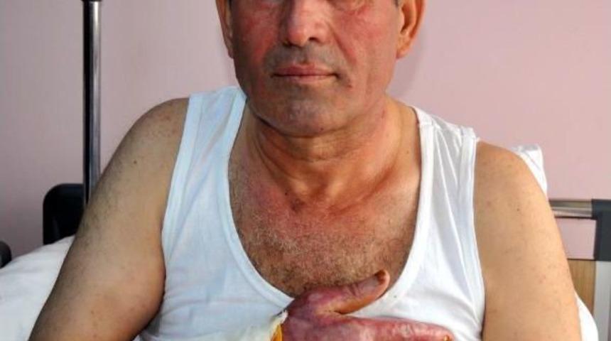 Yangını S&ouml;nd&uuml;rmek İsterken Kendini Yaktı