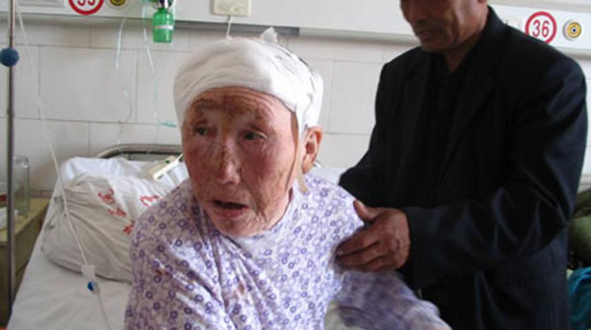  Yaşlı kadından &ccedil;ıkanlar doktorları şaşkına &ccedil;evirdi!