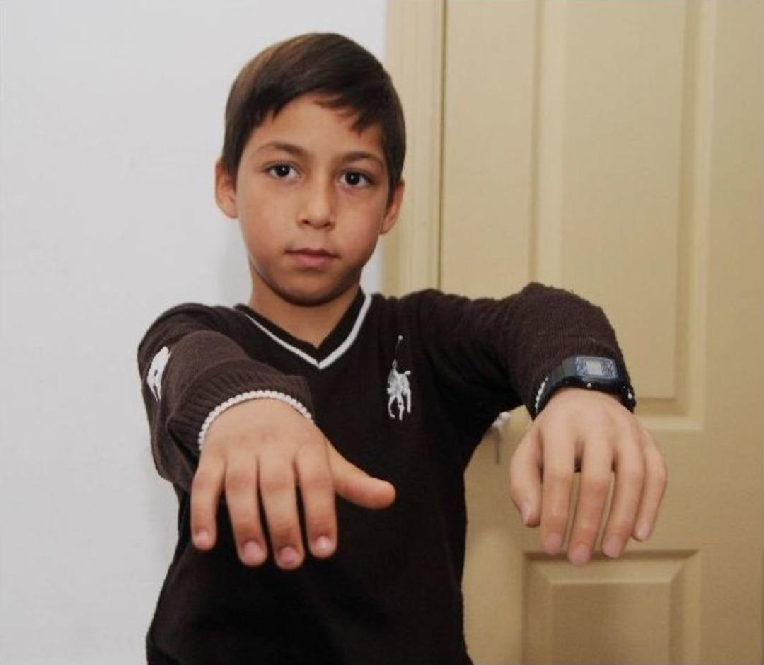 Artık &rsquo;kolsuz Ali&rsquo; Diyemeyecekler