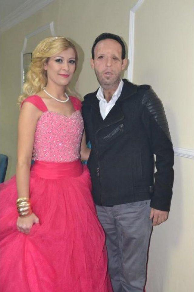 Yüz Nakilli Recep Sert in Düğünü Öncesi Kına Gecesinde Mutluluk Gözyaşları 1