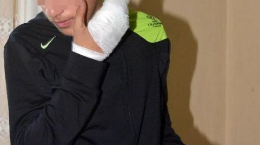 D&uuml;şen Paketi A&ccedil;tı, Patlama Oldu, G&ouml;z&uuml;n&uuml; Kaybetti