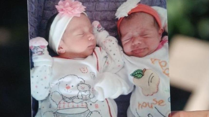 İkiz Bebekleri &Ouml;l&uuml;m Ayırdı