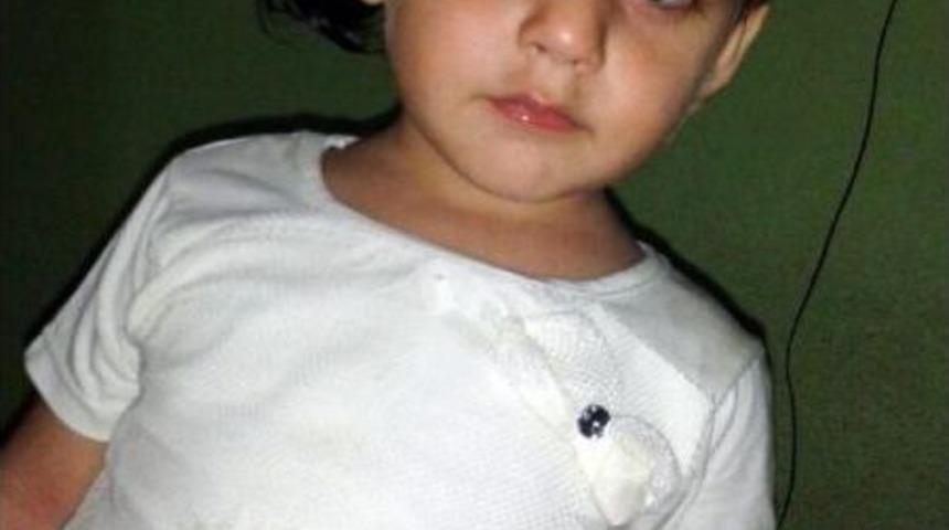 Kaynar Su Kazanına D&uuml;şen Suriyeli Minik Kız &Ouml;ld&uuml;