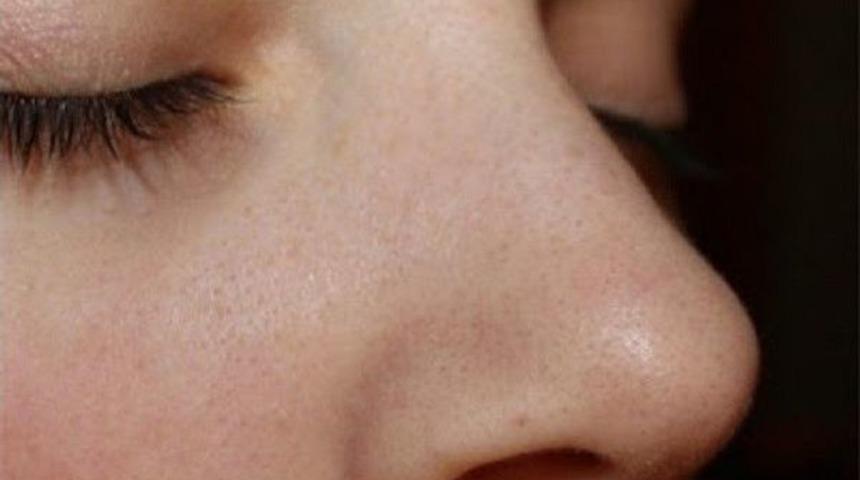 Burun Tıkanıklığı Sinüzite Neden Olabiliyor