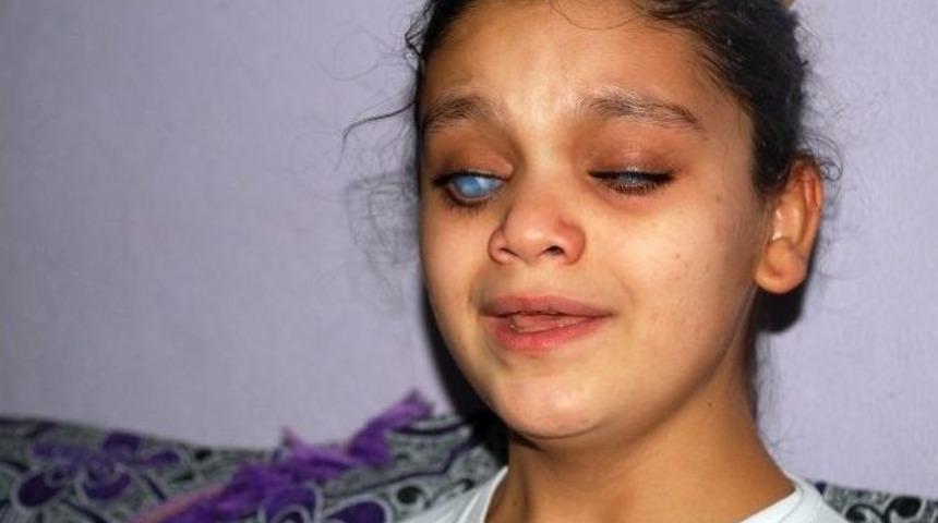 Doğuştan G&ouml;rme Engelli Kardeşler, &rsquo;ışık&rsquo; İ&ccedil;in Yardım Bekliyor
