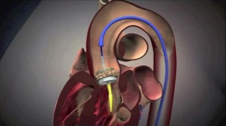 Sa&uuml; Tıp Fak&uuml;ltesi&rsquo;nde &rsquo;tavı&rsquo; Uygulaması