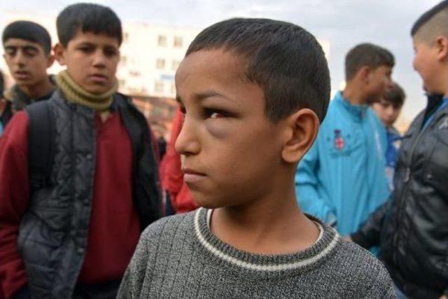 11 Yaşındaki &Ouml;ğrenciye M&uuml;stahdem Dayağı 1