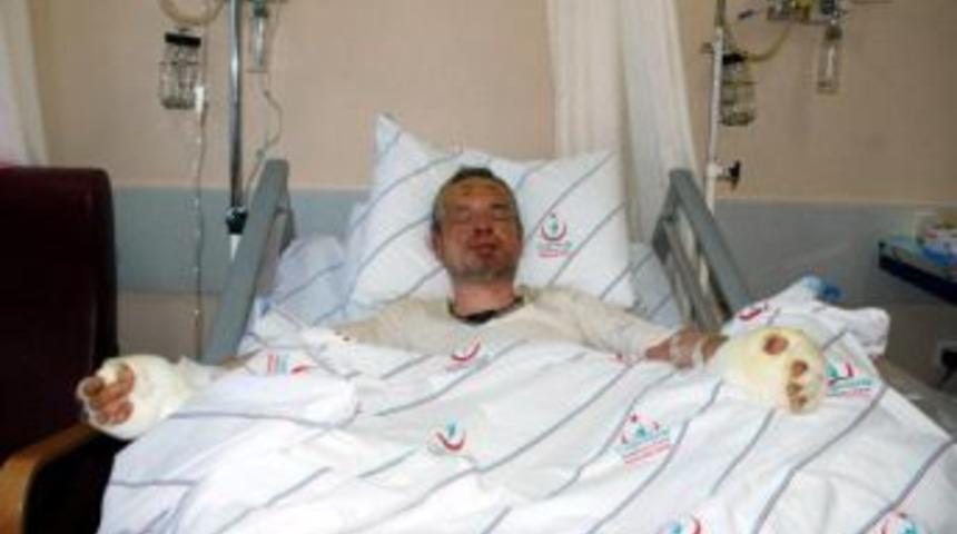 Banyoda &Ccedil;akmak Parlayınca Yandı