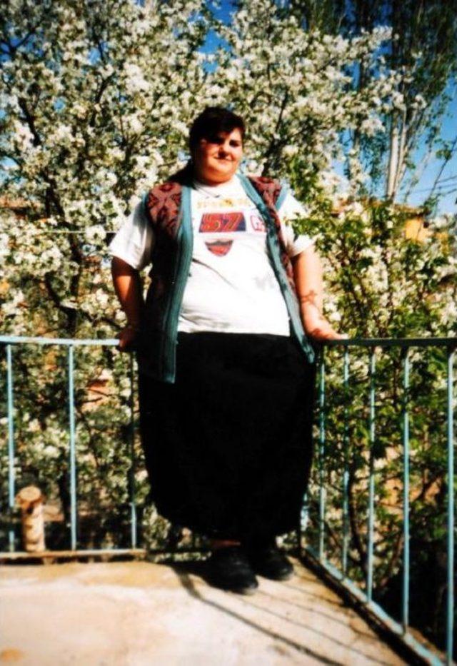 2.5 Yılda 135 Kilo Verdi 2