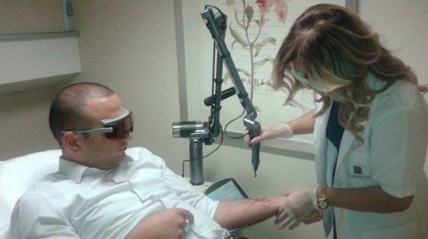 D&ouml;vmelerden Lazerle Kurtulmak M&uuml;mk&uuml;n