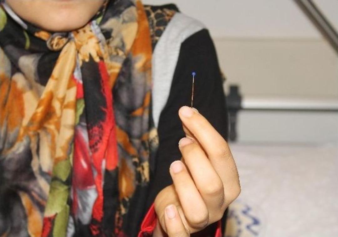 Nefes Borusundan Toplu İğne &Ccedil;ıkardılar