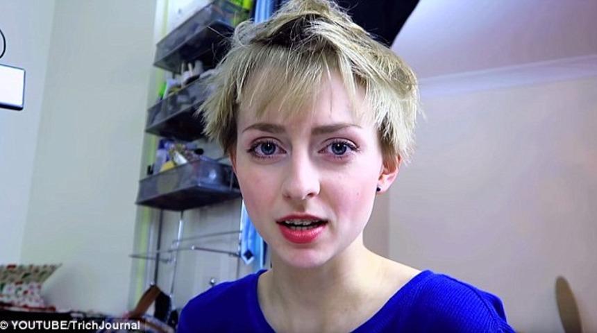 Hastalığı y&uuml;z&uuml;nden sa&ccedil;larını kazımak zorunda kaldı