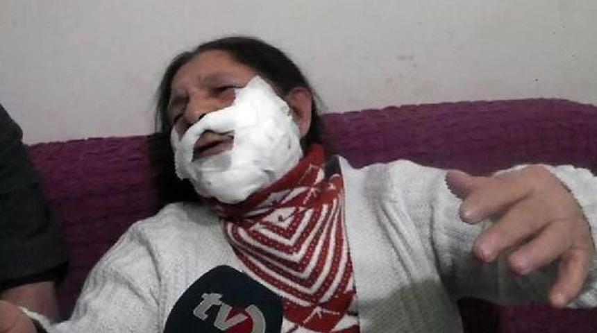Mutfak Dolabı D&uuml;şt&uuml;, Yemek Yapan Kadın Yaralandı